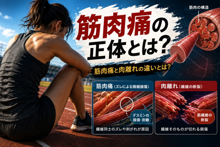 筋肉痛の正体