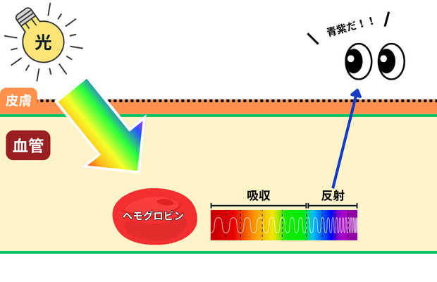 皮膚の下の血液で赤い光が吸収され、青紫が目に戻る様子の図