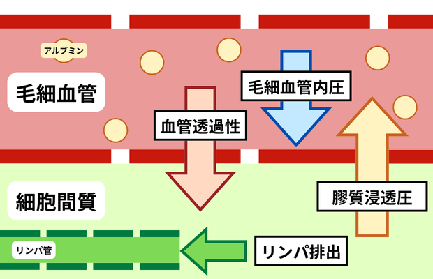 浮腫における病態全体図